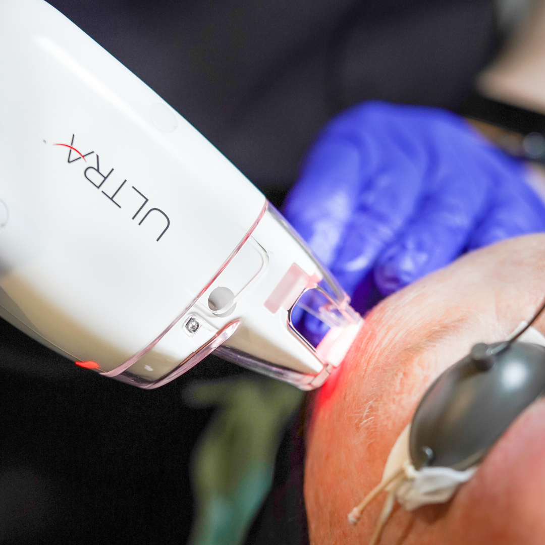 LaseMD Ultra Lutronic