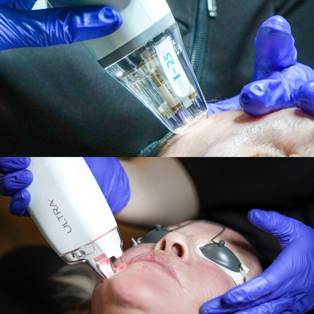 Ultra Skin Solutions