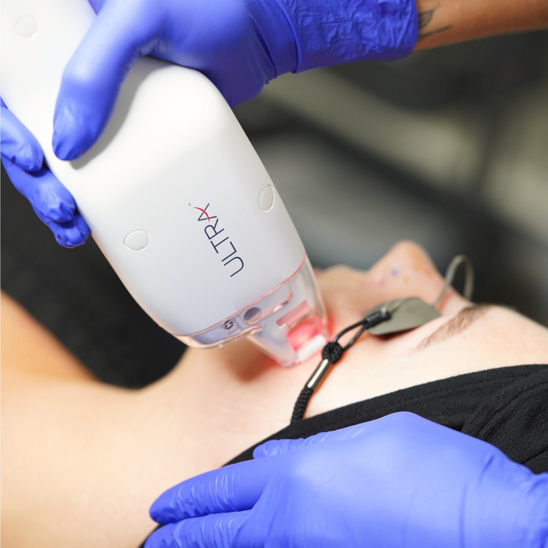 LaseMD Ultra Lutronic