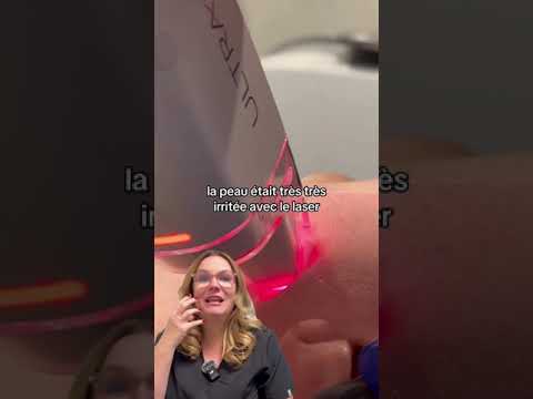 LaseMD Ultra Lutronic
