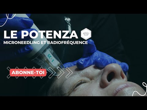 Microneedling RF Potenza