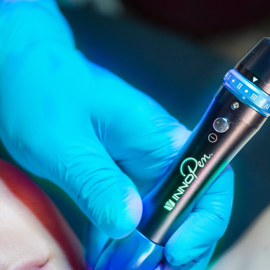 Microneedling, InnoPen