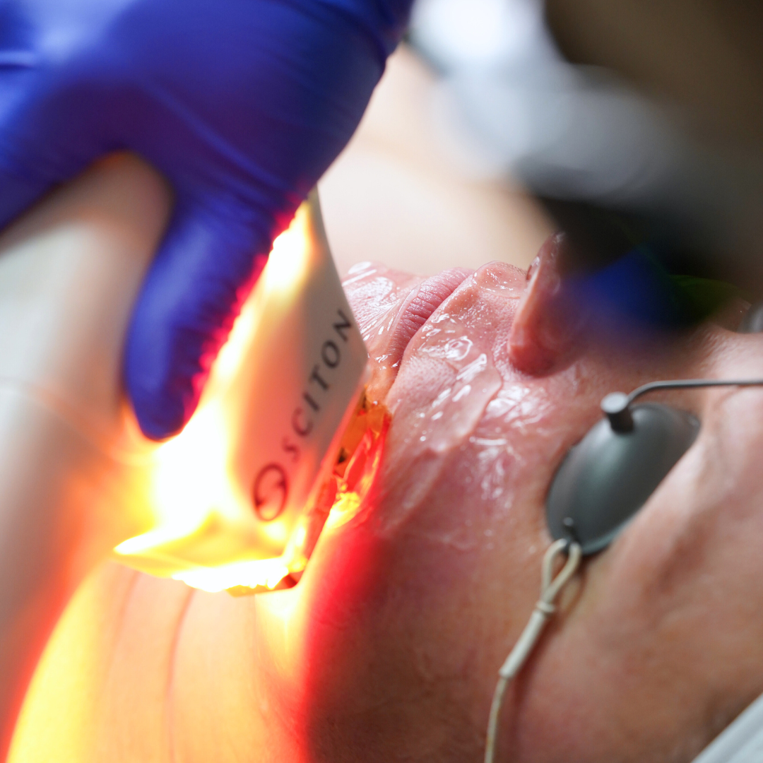 Laser et technologie