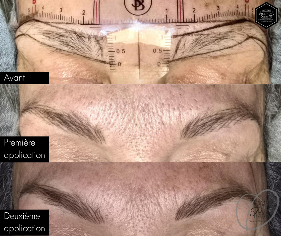 Maquillage permanent