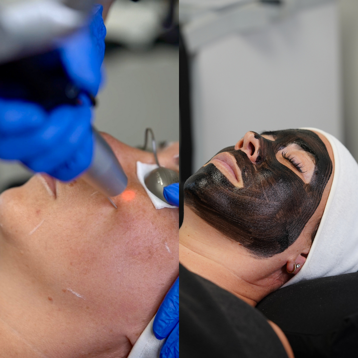 Photofacial Nano Glow