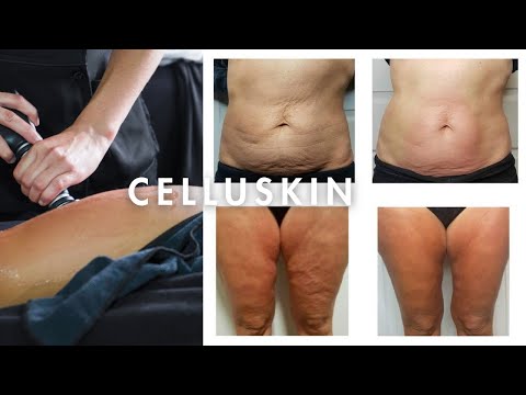 Celluskin soin anti-cellulite