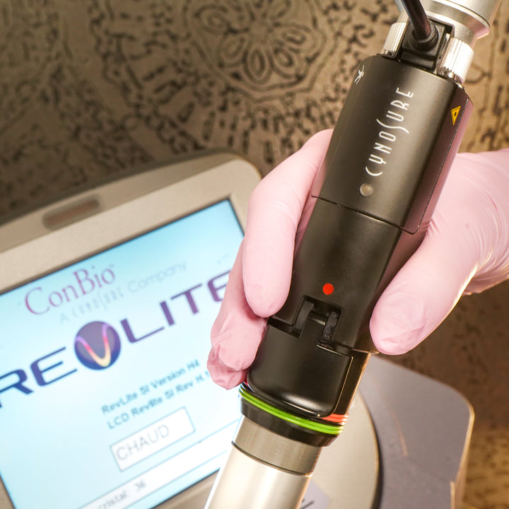 Photofacial Revlite