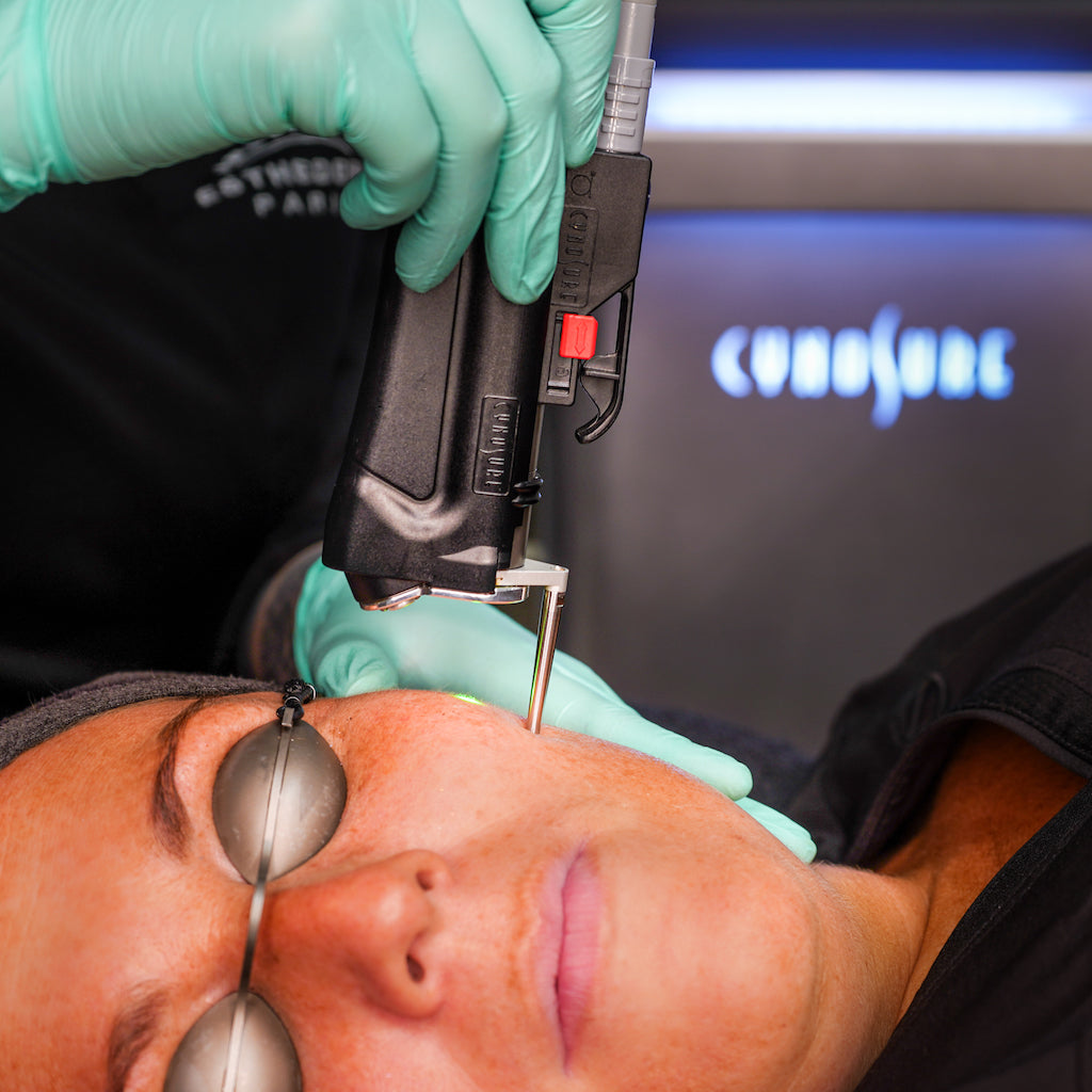 Laser ciblé pour tache  -  Alexandrite