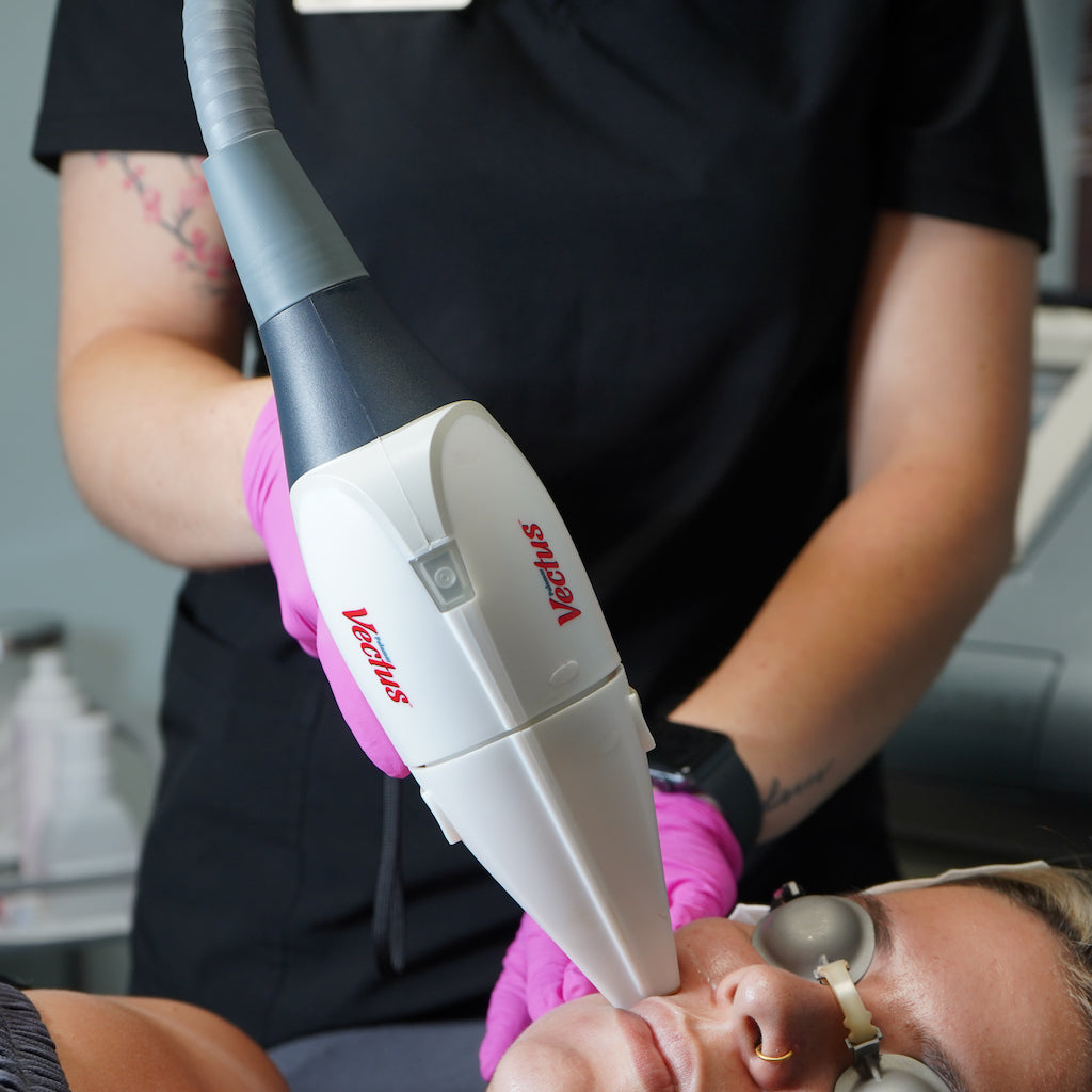 Épilation au laser (Diode, Alexandrite et YAG)